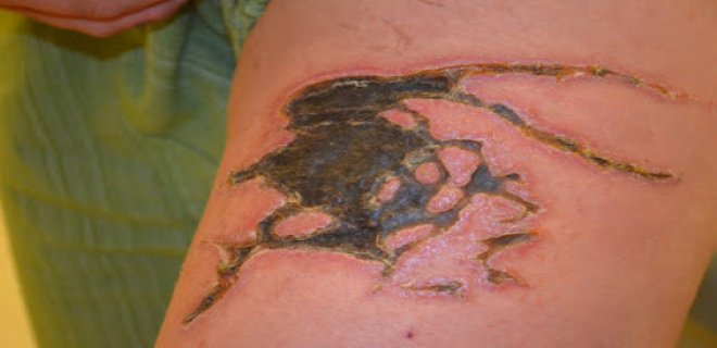 [Resim: denizanasi-009.jpg]